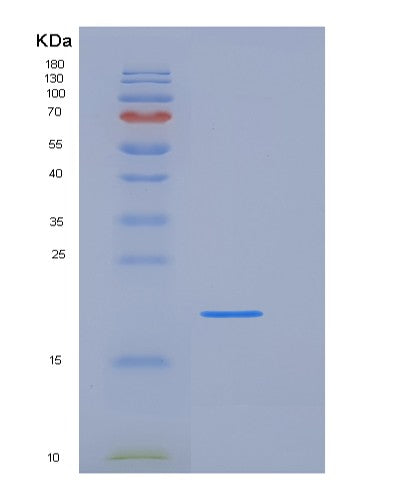 SDS-PAGE analysis of Human DUSP3 (Dual Specificity Protein Phosphatase 3) - Recombinant Protein, CATHuman DUSP3 (Dual Specificity Protein Phosphatase 3) - Recombinant Protein