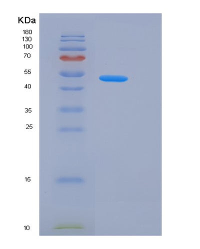 SDS-PAGE analysis of Mouse Kng1 (Kininogen-1) - Recombinant Protein, CAT# BLT-06185P, showing >90% purity under 15% SDS-PAGE (Reduced)Mouse Kng1 (Kininogen-1) - Recombinant Protein