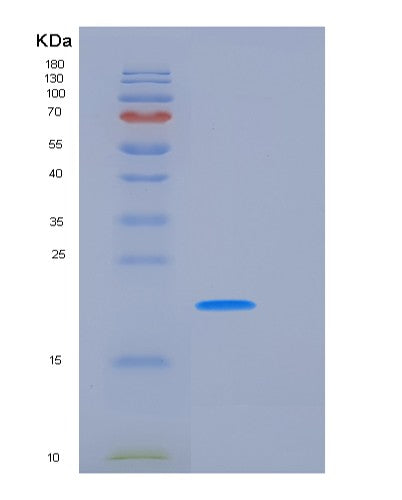 SDS-PAGE analysis of Human CLEC3B (Tetranectin) - Recombinant Protein, CATHuman CLEC3B (Tetranectin) - Recombinant Protein