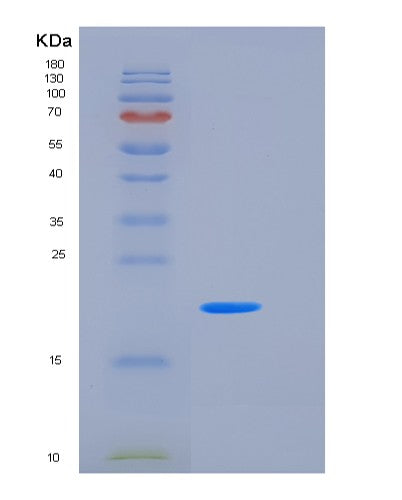 SDS-PAGE analysis of Mouse Clec3b (Tetranectin) - Recombinant Protein, CATMouse Clec3b (Tetranectin) - Recombinant Protein