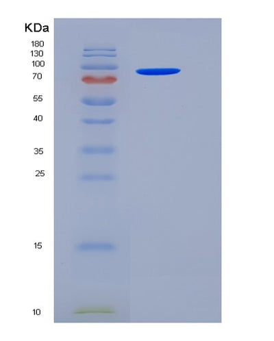 SDS-PAGE analysis of Human HSPD1 (60 Kda Heat Shock Protein, Mitochondrial) - Recombinant Protein, CAT# BLT-06194P, showing >90% purity under 15% SDS-PAGE (Reduced)Human HSPD1 (60 Kda Heat Shock Protein, Mitochondrial) - Recombinant Protein