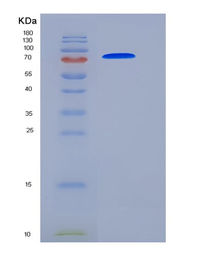 SDS-PAGE analysis of Human TGM2 (Protein-Glutamine Gamma-Glutamyltransferase 2) - Recombinant Protein, CAT# BLT-06196P, showing >90% purity under 15% SDS-PAGE (Reduced)Human TGM2 (Protein-Glutamine Gamma-Glutamyltransferase 2) - Recombinant Protein