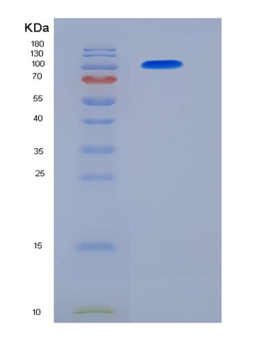 SDS-PAGE analysis of Human ACE2 (Angiotensin-Converting Enzyme 2) - Recombinant Protein, CAT# BLT-06198P, showing >85% purity under 15% SDS-PAGE (Reduced)Human ACE2 (Angiotensin-Converting Enzyme 2) - Recombinant Protein