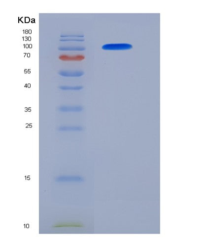 SDS-PAGE analysis of Human ACE2 (Angiotensin-Converting Enzyme 2) - Recombinant Protein, CATHuman ACE2 (Angiotensin-Converting Enzyme 2) - Recombinant Protein