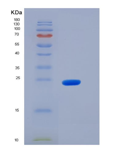 SDS-PAGE analysis of Mouse Jam2 (Junctional Adhesion Molecule B) - Recombinant Protein, CAT# BLT-06199P, showing >95% purity under 15% SDS-PAGE (Reduced)Mouse Jam2 (Junctional Adhesion Molecule B) - Recombinant Protein