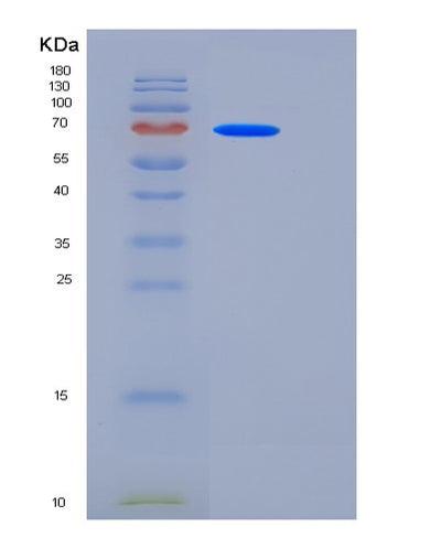 SDS-PAGE analysis of Human CEACAM5 (Cell Adhesion Molecule Ceacam5) - Recombinant Protein, CAT# BLT-06204P, showing >85% purity under 15% SDS-PAGE (Reduced)Human CEACAM5 (Cell Adhesion Molecule Ceacam5) - Recombinant Protein