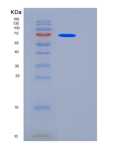 SDS-PAGE analysis of Human CEACAM5 (Cell Adhesion Molecule Ceacam5) - Recombinant Protein, CATHuman CEACAM5 (Cell Adhesion Molecule Ceacam5) - Recombinant Protein