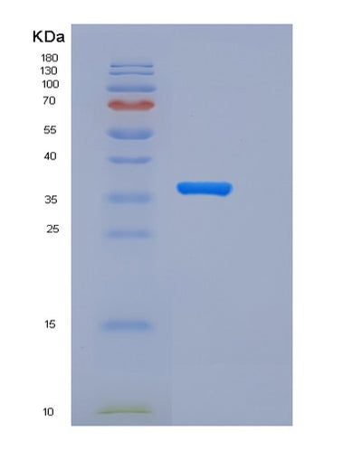SDS-PAGE analysis of Human CD55 (Complement Decay-Accelerating Factor) - Recombinant Protein, CAT# BLT-06215P, showing >90% purity under 15% SDS-PAGE (Reduced)Human CD55 (Complement Decay-Accelerating Factor) - Recombinant Protein
