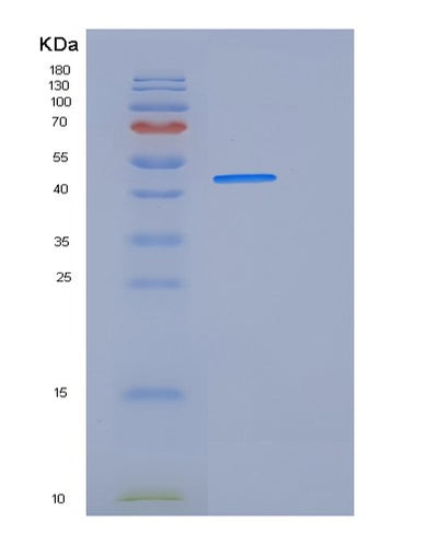 SDS-PAGE analysis of Human ACY1 (Aminoacylase-1) - Recombinant Protein, CAT# BLT-06219P, showing >85% purity under 15% SDS-PAGE (Reduced)Human ACY1 (Aminoacylase-1) - Recombinant Protein