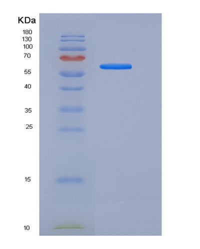 SDS-PAGE analysis of Human CD55 (Complement Decay-Accelerating Factor) - Recombinant Protein, CAT# BLT-06220P, showing >95% purity under 15% SDS-PAGE (Reduced)Human CD55 (Complement Decay-Accelerating Factor) - Recombinant Protein