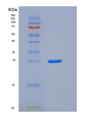 SDS-PAGE analysis of Human SDC1 (Syndecan-1) - Recombinant Protein, CAT# BLT-06222P, showing >95% purity under 15% SDS-PAGE (Reduced)Human SDC1 (Syndecan-1) - Recombinant Protein