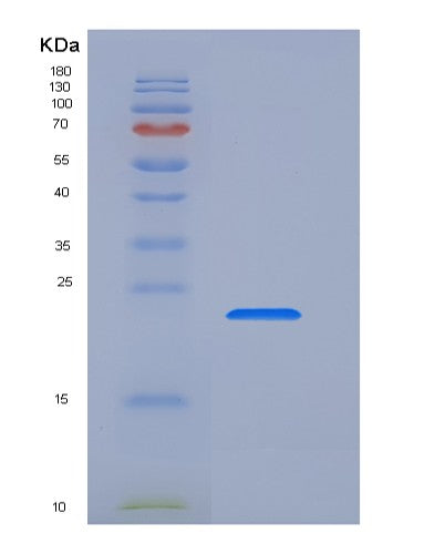SDS-PAGE analysis of Human TFPI2 (Tissue Factor Pathway Inhibitor 2) - Recombinant Protein, CATHuman TFPI2 (Tissue Factor Pathway Inhibitor 2) - Recombinant Protein