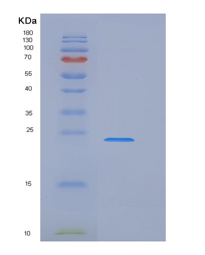 SDS-PAGE analysis of Human CD84 (Slam Family Member 5) - Recombinant Protein, CATHuman CD84 (Slam Family Member 5) - Recombinant Protein