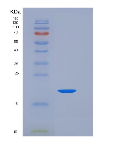 SDS-PAGE analysis of Human CD7 (T-Cell Antigen Cd7) - Recombinant Protein, CATHuman CD7 (T-Cell Antigen Cd7) - Recombinant Protein