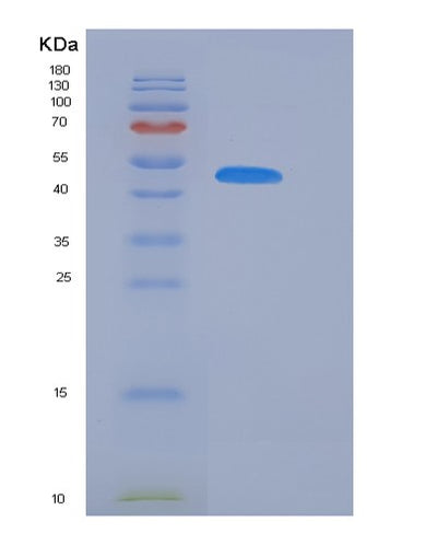 SDS-PAGE analysis of Mouse Serpina11 (Serpin A11) - Recombinant Protein, CAT# BLT-06237P, showing >85% purity under 15% SDS-PAGE (Reduced)Mouse Serpina11 (Serpin A11) - Recombinant Protein
