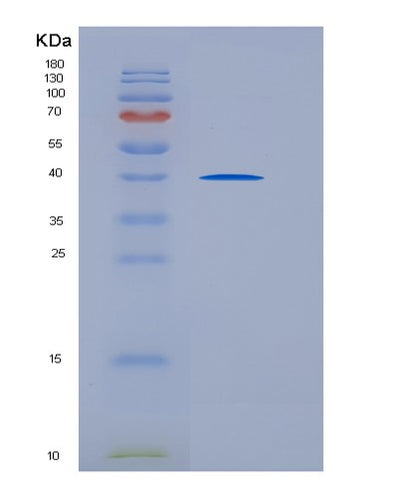 SDS-PAGE analysis of Human CD5 (T-Cell Surface Glycoprotein Cd5) - Recombinant Protein, CAT# BLT-06238P, showing >95% purity under 15% SDS-PAGE (Reduced)Human CD5 (T-Cell Surface Glycoprotein Cd5) - Recombinant Protein