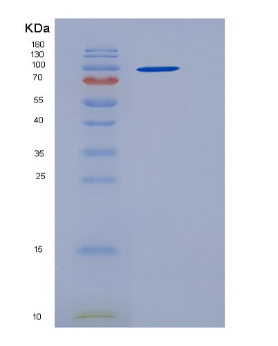 SDS-PAGE analysis of Mouse Mdga2 (Mam Domain-Containing Glycosylphosphatidylinositol Anchor Protein 2) - Recombinant Protein, CATMouse Mdga2 (Mam Domain-Containing Glycosylphosphatidylinositol Anchor Protein 2) - Recombinant Protein