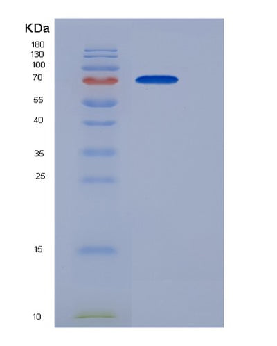 SDS-PAGE analysis of Human KNG1 (Kininogen-1) - Recombinant Protein, CAT# BLT-06242P, showing >90% purity under 15% SDS-PAGE (Reduced)Human KNG1 (Kininogen-1) - Recombinant Protein