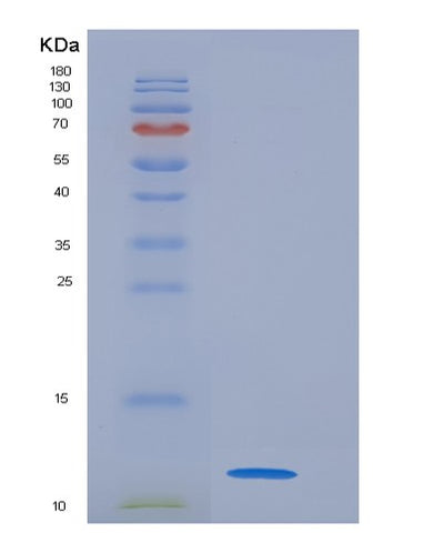 SDS-PAGE analysis of Mouse S100a5 (Protein S100-A5) - Recombinant Protein, CAT# BLT-06244P, showing >95% purity under 15% SDS-PAGE (Reduced)Mouse S100a5 (Protein S100-A5) - Recombinant Protein