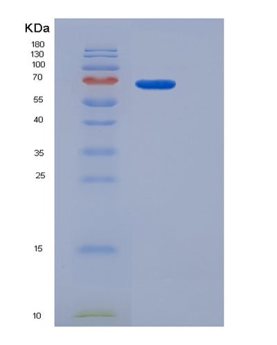 SDS-PAGE analysis of Human ADGRE5 (Adhesion G Protein-Coupled Receptor E5) - Recombinant Protein, CAT# BLT-06250P, showing >95% purity under 15% SDS-PAGE (Reduced)Human ADGRE5 (Adhesion G Protein-Coupled Receptor E5) - Recombinant Protein