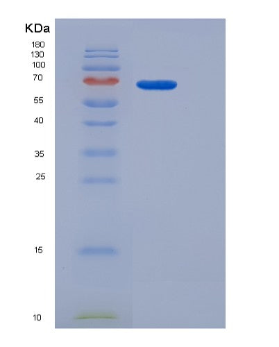 SDS-PAGE analysis of Human ADGRE5 (Adhesion G Protein-Coupled Receptor E5) - Recombinant Protein, CATHuman ADGRE5 (Adhesion G Protein-Coupled Receptor E5) - Recombinant Protein