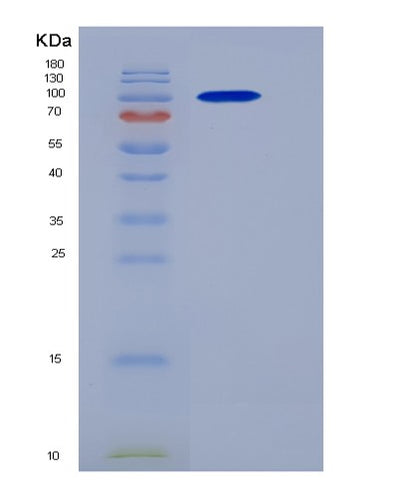 SDS-PAGE analysis of Human CTNNB1 (Catenin Beta-1) - Recombinant Protein, CAT# BLT-06256P, showing >90% purity under 15% SDS-PAGE (Reduced)Human CTNNB1 (Catenin Beta-1) - Recombinant Protein