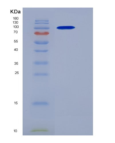 SDS-PAGE analysis of Human CTNNB1 (Catenin Beta-1) - Recombinant Protein, CATHuman CTNNB1 (Catenin Beta-1) - Recombinant Protein
