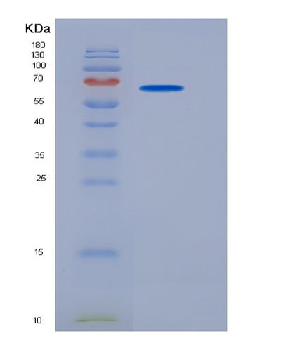 SDS-PAGE analysis of Mouse Bche (Cholinesterase) - Recombinant Protein, CAT# BLT-06258P, showing >85% purity under 15% SDS-PAGE (Reduced)Mouse Bche (Cholinesterase) - Recombinant Protein