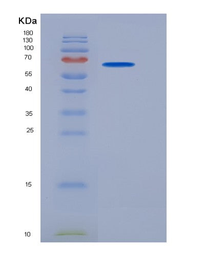 SDS-PAGE analysis of Mouse Bche (Cholinesterase) - Recombinant Protein, CATMouse Bche (Cholinesterase) - Recombinant Protein