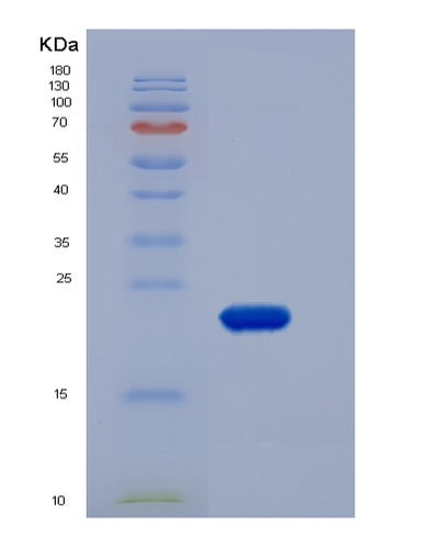 SDS-PAGE analysis of Human CLEC1B (C-Type Lectin Domain Family 1 Member B) - Recombinant Protein, CAT# BLT-06262P, showing >95% purity under 15% SDS-PAGE (Reduced)Human CLEC1B (C-Type Lectin Domain Family 1 Member B) - Recombinant Protein