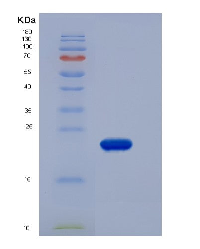 SDS-PAGE analysis of Human CLEC1B (C-Type Lectin Domain Family 1 Member B) - Recombinant Protein, CATHuman CLEC1B (C-Type Lectin Domain Family 1 Member B) - Recombinant Protein