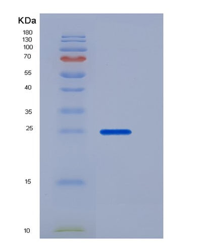 SDS-PAGE analysis of Mouse Fcgr4 (Low Affinity Immunoglobulin Gamma Fc Region Receptor Iii-A) - Recombinant Protein, CAT# BLT-06264P, showing >85% purity under 15% SDS-PAGE (Reduced)Mouse Fcgr4 (Low Affinity Immunoglobulin Gamma Fc Region Receptor Iii-A) - Recombinant Protein