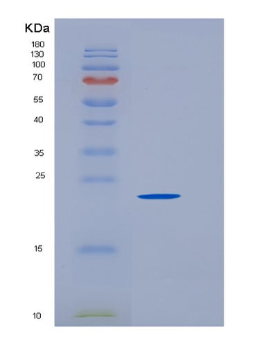 SDS-PAGE analysis of Mouse Fcrl1 (Fc Receptor-Like Protein 1) - Recombinant Protein, CAT# BLT-06266P, showing >95% purity under 15% SDS-PAGE (Reduced)Mouse Fcrl1 (Fc Receptor-Like Protein 1) - Recombinant Protein