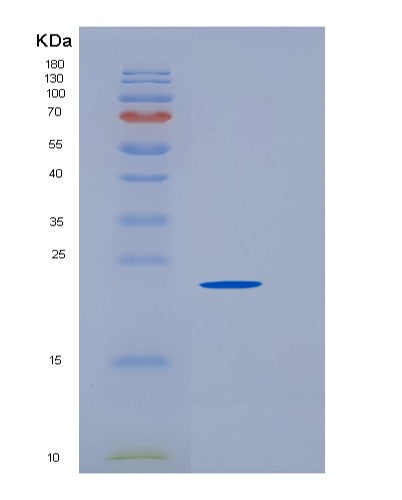 SDS-PAGE analysis of Mouse Fcrl1 (Fc Receptor-Like Protein 1) - Recombinant Protein, CATMouse Fcrl1 (Fc Receptor-Like Protein 1) - Recombinant Protein