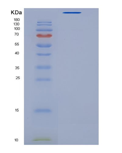 SDS-PAGE analysis of Human VWF (Von Willebrand Factor) - Recombinant Protein, CAT# BLT-06581P, showing >95% purity under 15% SDS-PAGE (Reduced)Human VWF (Von Willebrand Factor) - Recombinant Protein