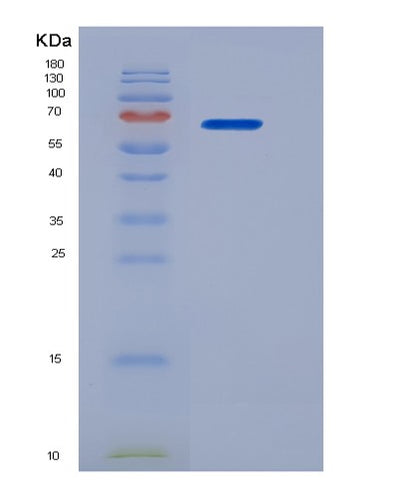 SDS-PAGE analysis of Human SELE (E-Selectin) - Recombinant Protein, CAT# BLT-06272P, showing >90% purity under 15% SDS-PAGE (Reduced)Human SELE (E-Selectin) - Recombinant Protein