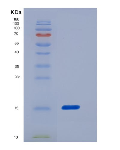 SDS-PAGE analysis of Human FABP5 (Fatty Acid-Binding Protein 5) - Recombinant Protein, CAT# BLT-06273P, showing >85% purity under 15% SDS-PAGE (Reduced)Human FABP5 (Fatty Acid-Binding Protein 5) - Recombinant Protein