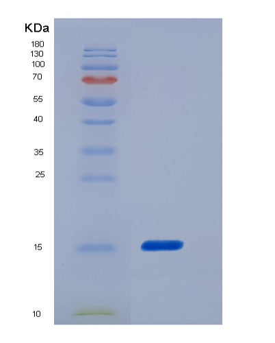 SDS-PAGE analysis of Human FABP5 (Fatty Acid-Binding Protein 5) - Recombinant Protein, CATHuman FABP5 (Fatty Acid-Binding Protein 5) - Recombinant Protein