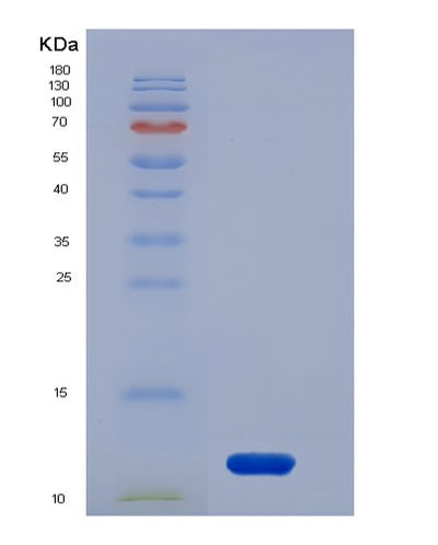 SDS-PAGE analysis of Human ACVRL1 (Activin Receptor Type-1-Like) - Recombinant Protein, CAT# BLT-06277P, showing >95% purity under 15% SDS-PAGE (Reduced)Human ACVRL1 (Activin Receptor Type-1-Like) - Recombinant Protein