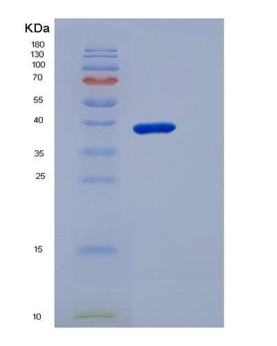SDS-PAGE analysis of Mouse Cd5 (T-Cell Surface Glycoprotein Cd5) - Recombinant Protein, CAT# BLT-06281P, showing >90% purity under 15% SDS-PAGE (Reduced)Mouse Cd5 (T-Cell Surface Glycoprotein Cd5) - Recombinant Protein