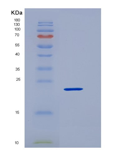 SDS-PAGE analysis of Human MESD (Lrp Chaperone Mesd) - Recombinant Protein, CATHuman MESD (Lrp Chaperone Mesd) - Recombinant Protein