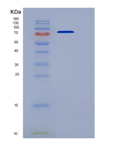 SDS-PAGE analysis of Human BACE1 (Beta-Secretase 1) - Recombinant Protein, CAT# BLT-06284P, showing >90% purity under 15% SDS-PAGE (Reduced)Human BACE1 (Beta-Secretase 1) - Recombinant Protein