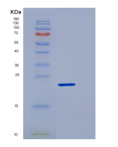 SDS-PAGE analysis of Human TREM1 (Triggering Receptor Expressed On Myeloid Cells 1) - Recombinant Protein, CATHuman TREM1 (Triggering Receptor Expressed On Myeloid Cells 1) - Recombinant Protein