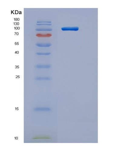 SDS-PAGE analysis of Human ACE2 (Angiotensin-Converting Enzyme 2) - Recombinant Protein, CAT# BLT-06294P, showing >85% purity under 15% SDS-PAGE (Reduced)Human ACE2 (Angiotensin-Converting Enzyme 2) - Recombinant Protein