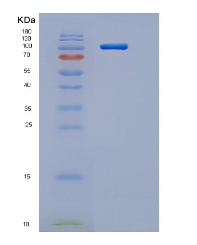 SDS-PAGE analysis of Human ACE2 (Angiotensin-Converting Enzyme 2) - Recombinant Protein, CATHuman ACE2 (Angiotensin-Converting Enzyme 2) - Recombinant Protein