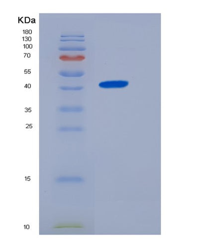 SDS-PAGE analysis of Human CTSD (Cathepsin D) - Recombinant Protein, CAT# BLT-06312P, showing >85% purity under 15% SDS-PAGE (Reduced)Human CTSD (Cathepsin D) - Recombinant Protein