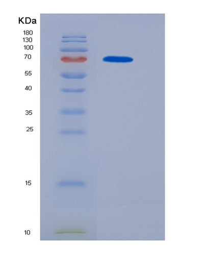 SDS-PAGE analysis of Human OSMR (Oncostatin-M-Specific Receptor Subunit Beta) - Recombinant Protein, CAT# BLT-06313P, showing >95% purity under 15% SDS-PAGE (Reduced)Human OSMR (Oncostatin-M-Specific Receptor Subunit Beta) - Recombinant Protein