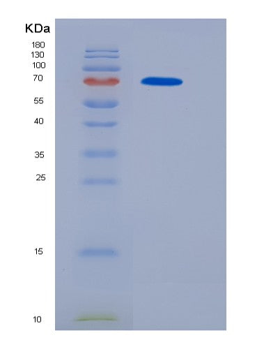 SDS-PAGE analysis of Human OSMR (Oncostatin-M-Specific Receptor Subunit Beta) - Recombinant Protein, CATHuman OSMR (Oncostatin-M-Specific Receptor Subunit Beta) - Recombinant Protein