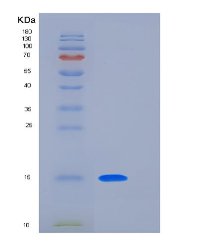 SDS-PAGE analysis of Human LAIR2 (Leukocyte-Associated Immunoglobulin-Like Receptor 2) - Recombinant Protein, CAT# BLT-06325P, showing >95% purity under 15% SDS-PAGE (Reduced)Human LAIR2 (Leukocyte-Associated Immunoglobulin-Like Receptor 2) - Recombinant Protein