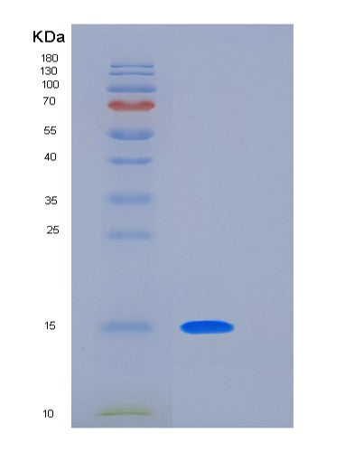 SDS-PAGE analysis of Human LAIR2 (Leukocyte-Associated Immunoglobulin-Like Receptor 2) - Recombinant Protein, CATHuman LAIR2 (Leukocyte-Associated Immunoglobulin-Like Receptor 2) - Recombinant Protein